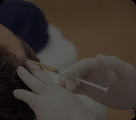 PRP Therapy