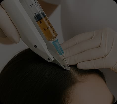 Mesotherapy