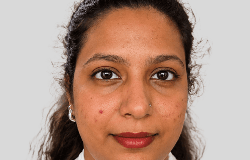 Ankita before Medi Facial treatment