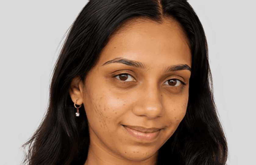Shravani after Chemical Peels treatment