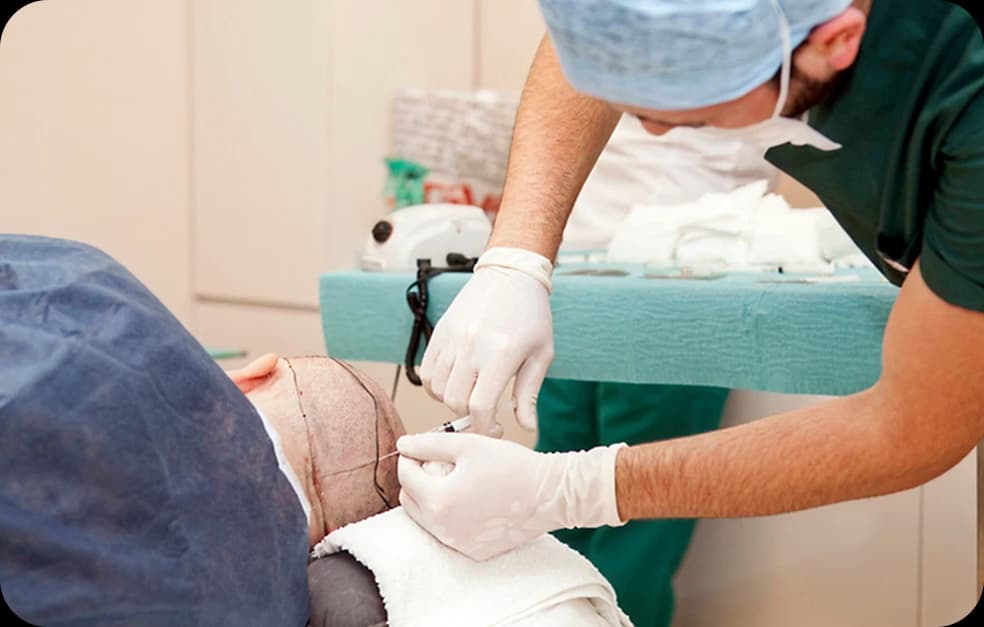 Real-Time FUE: Complete Guide to Advanced Hair Restoration Technique