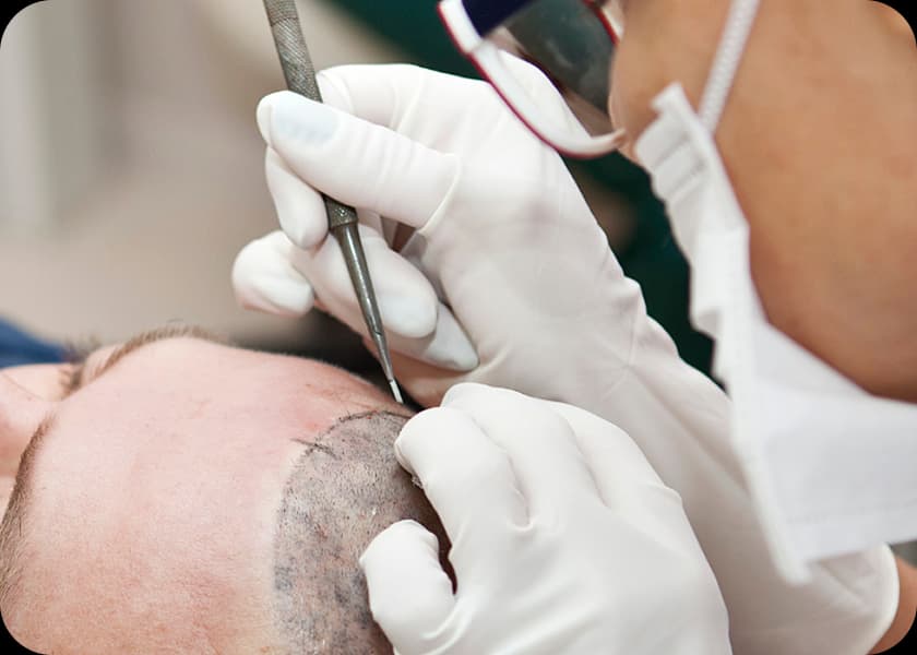 Initial consultation with doctor