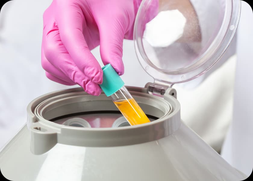 Step 3: Centrifugation