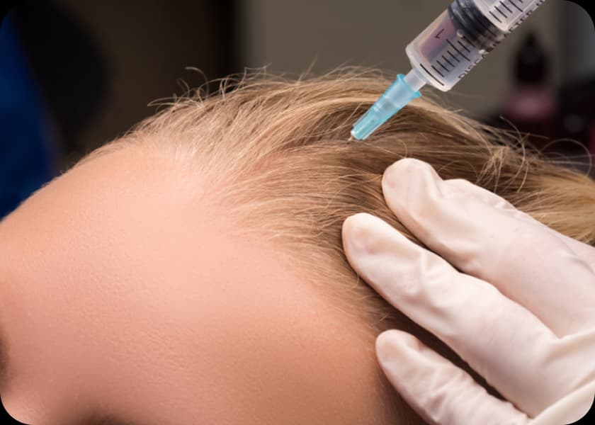Step 3: Injection Process