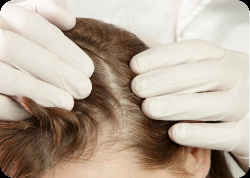 Step 4: Scalp Preparation