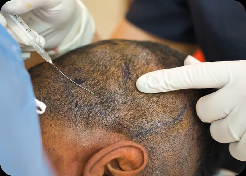 Step 1: Local Anaesthesia
