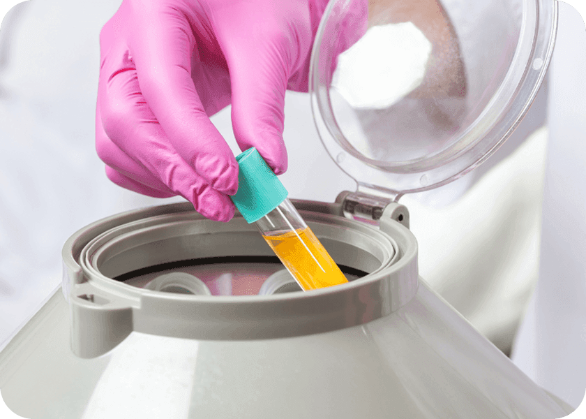 Step 3: Centrifugation