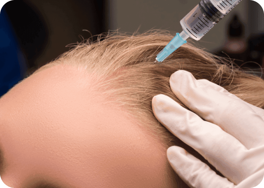 Step 3: Injection Process