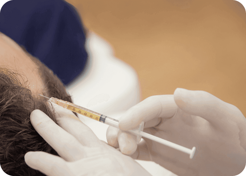 Step 4: Injection into the Scalp