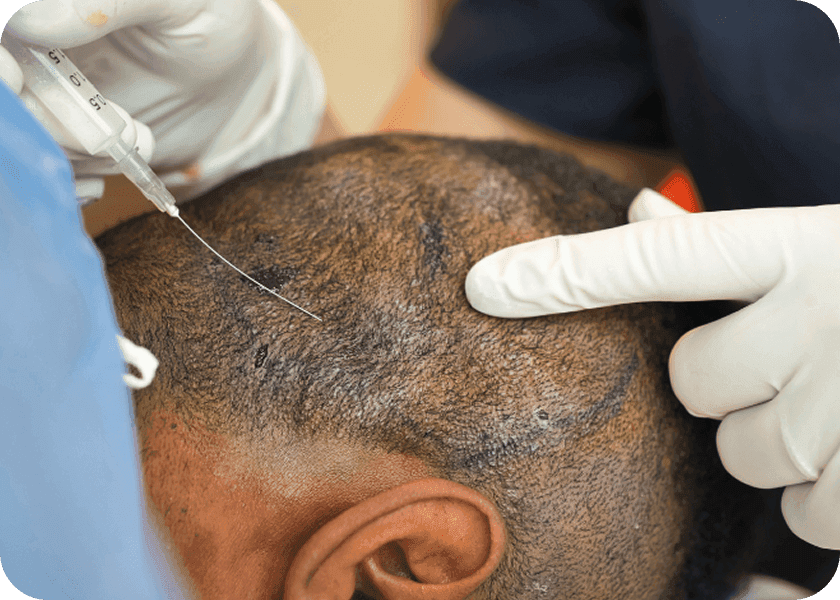 Step 1: Local Anaesthesia