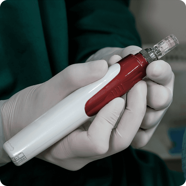 Microneedling for Hair Regrowth