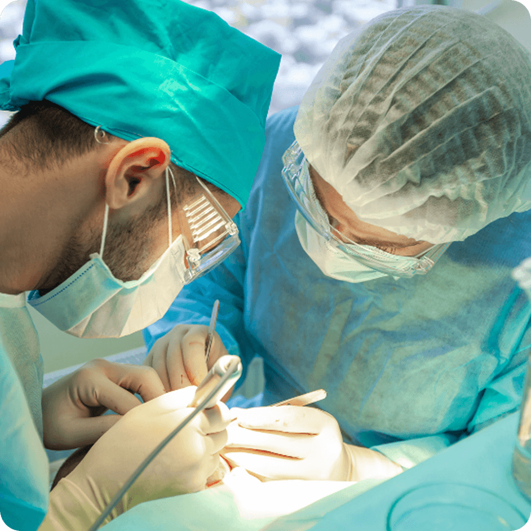 Real Time FUE Hair Transplant