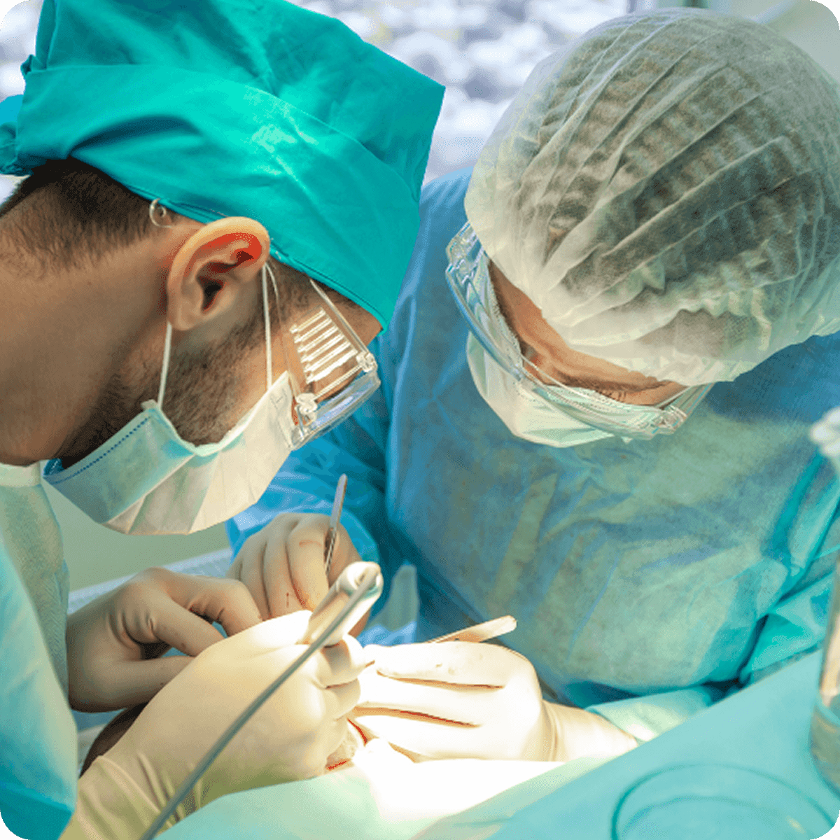 Real time FUE hair transplant showing live extraction and implantation