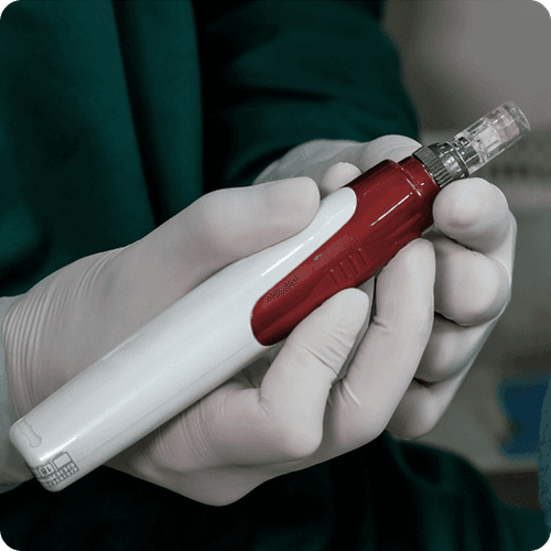 Introduction to Microneedling for Hair Growth