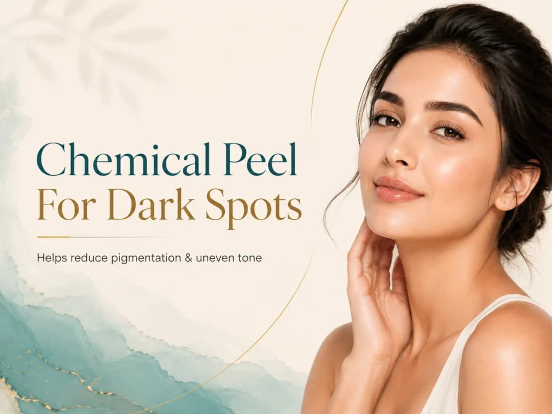 chemical peel for dark spots