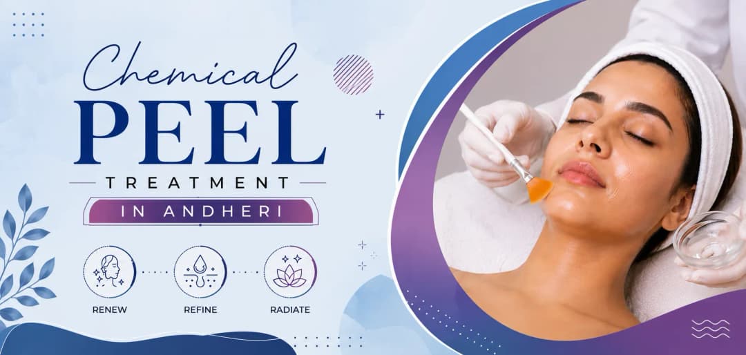 chemical peel treatment in andheri