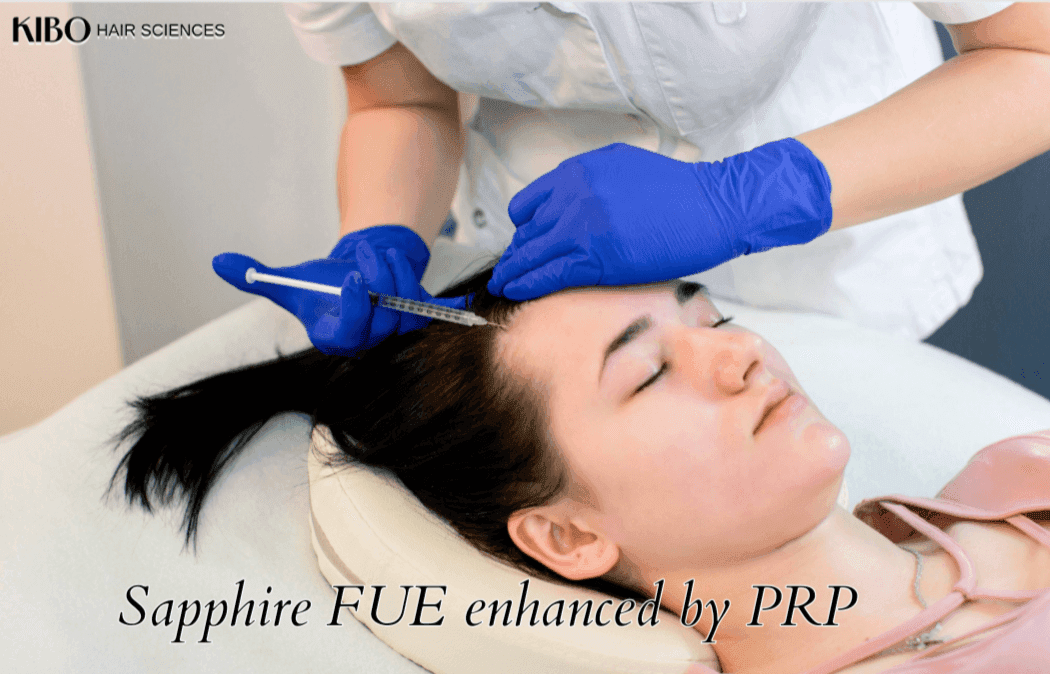 Combining Sapphire FUE with PRP: Maximizing Growth in Mumbai Treatments