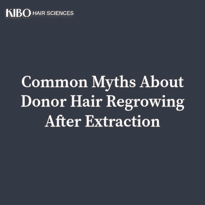 Common Myths About Donor Hair Regrowing After Extraction