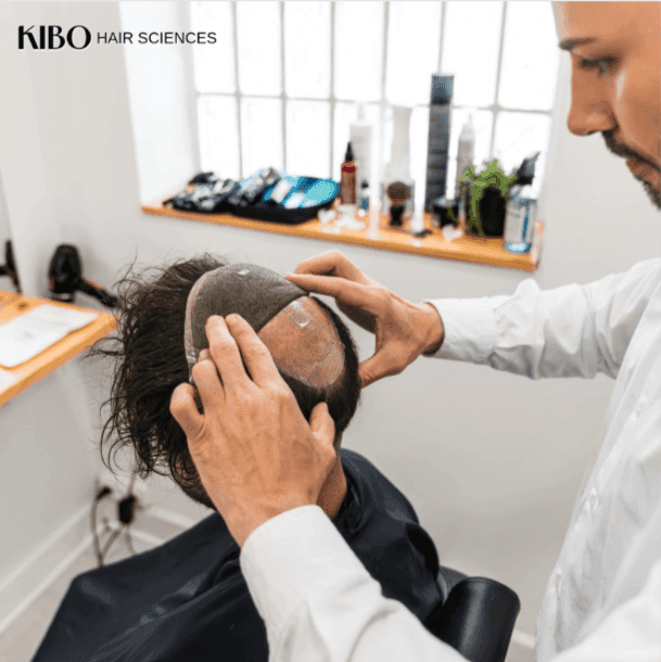 Hair transplant vs hair patch comparison for long term results