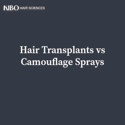 Hair Transplants vs Camouflage Sprays: Long-Term Outlook