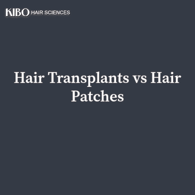 flat lay navy blue background with text "Hair Transplants vs Hair Patches" centred and in middle and on top left corner there is Kibo clinics logo
