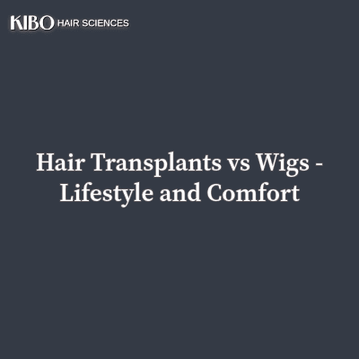 Hair Transplants vs Wigs: Lifestyle and Comfort Perspective