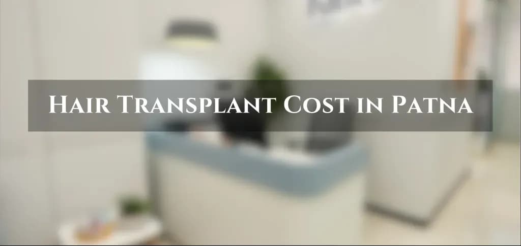 Hair transplant cost in Patna with pricing comparison