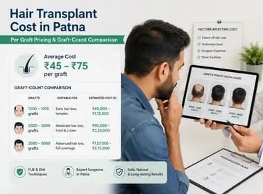 Hair Transplant Cost in Patna: Price Per Graft and Graft Estimates