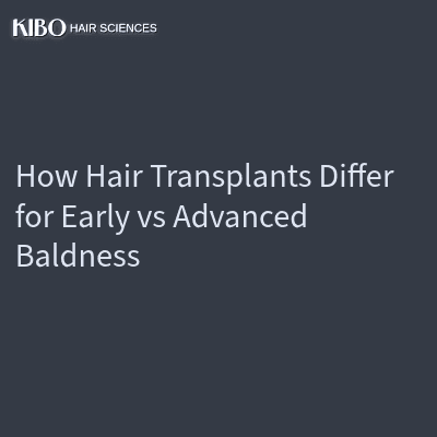 How Hair Transplants Differ for Early vs Advanced Baldness