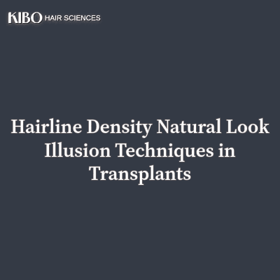 flat lay navy blue background with text "Hairline Density Natural Look Illusion Techniques in Transplants" centred and in middle and on top left corner there is Kibo clinics logo
