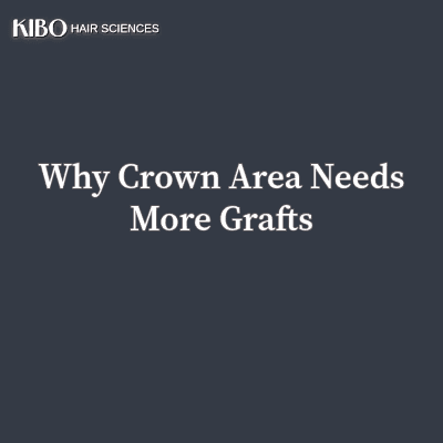 image with kibo logo on left top corner, in middle centre texts says "Why Crown Area Needs More Grafts" and background is navy blue flat lay