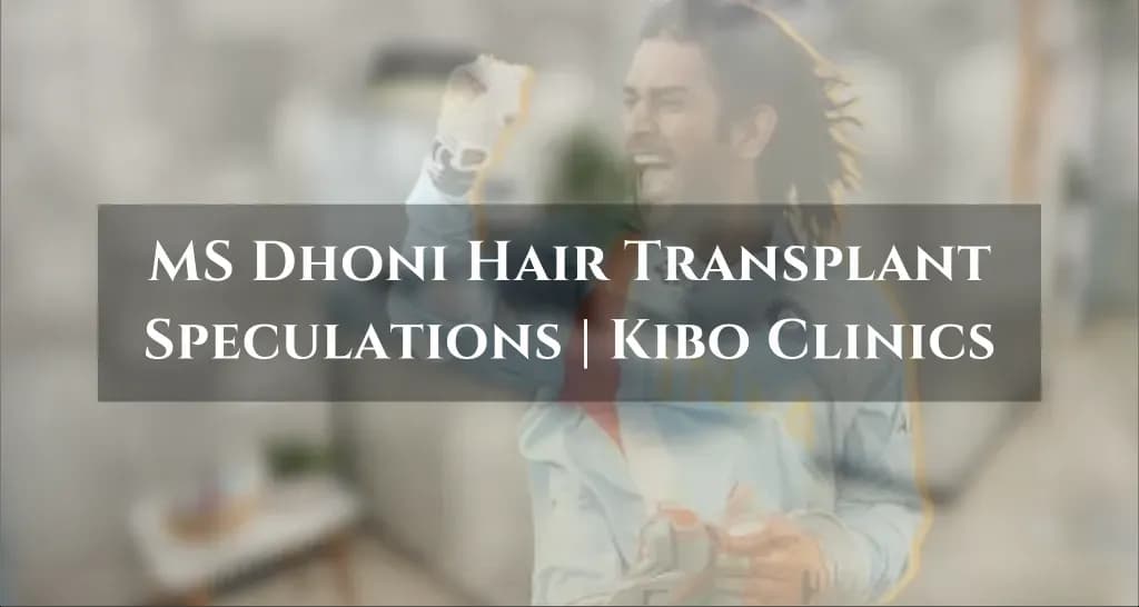ms dhoni hair transplant
