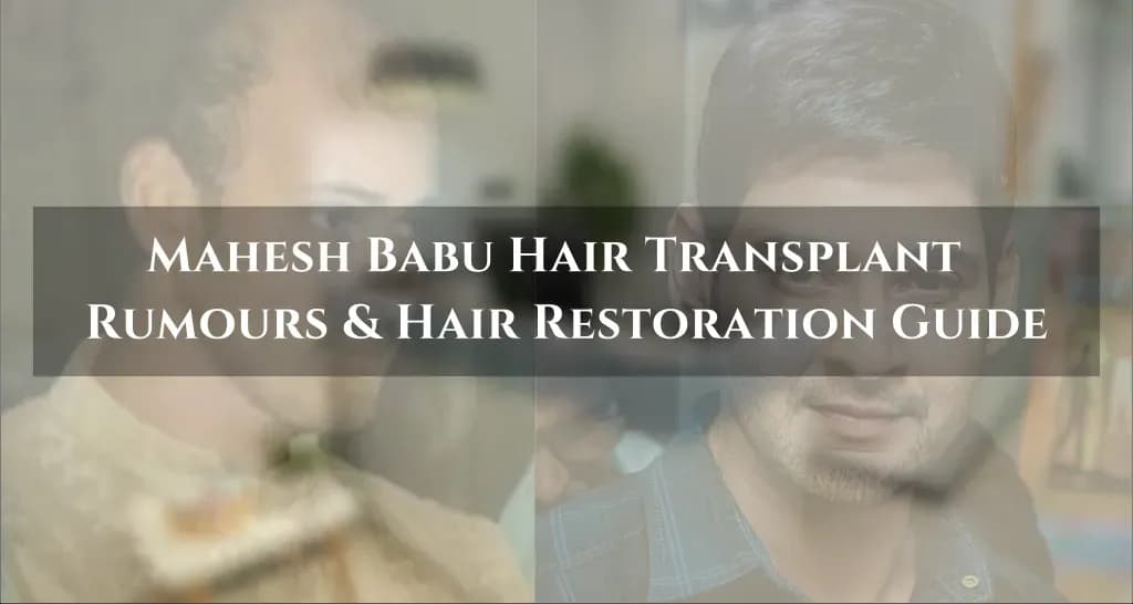 Mahesh Babu hair transplant