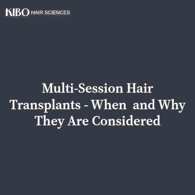 flat lay navy blue background with text "Multi-Session Hair Transplants: When and Why They Are Considered" centred and in middle and on top left corner there is Kibo clinics logo