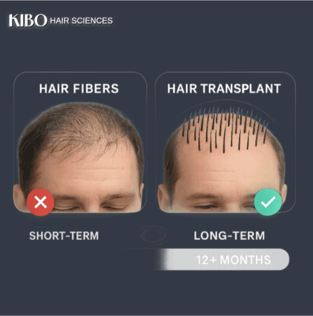 hair transplants vs hair fibres, natural looking hair restoration, mumbai hair transplant guide, hair fibres long term, kibo hair sciences
