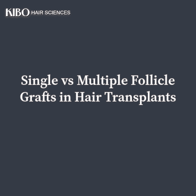 flat lay navy blue background with text "Single vs Multiple Follicle Grafts in Hair Transplants" centred and in middle and on top left corner there is Kibo clinics logo