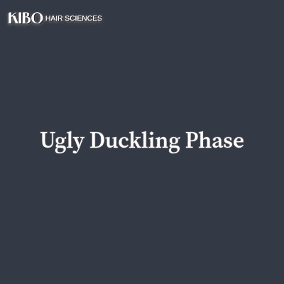 Understanding the “Ugly Duckling Phase” After a Hair Transplant