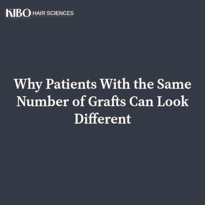 flat lay navy blue background with text "Why Patients With the Same Number of Grafts Can Look Different" centred and in middle and on top left corner there is Kibo clinics logo