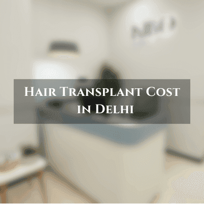 Hair Transplant Cost in Delhi: Pricing Breakdown, Techniques, and How to Choose the Right Clinic