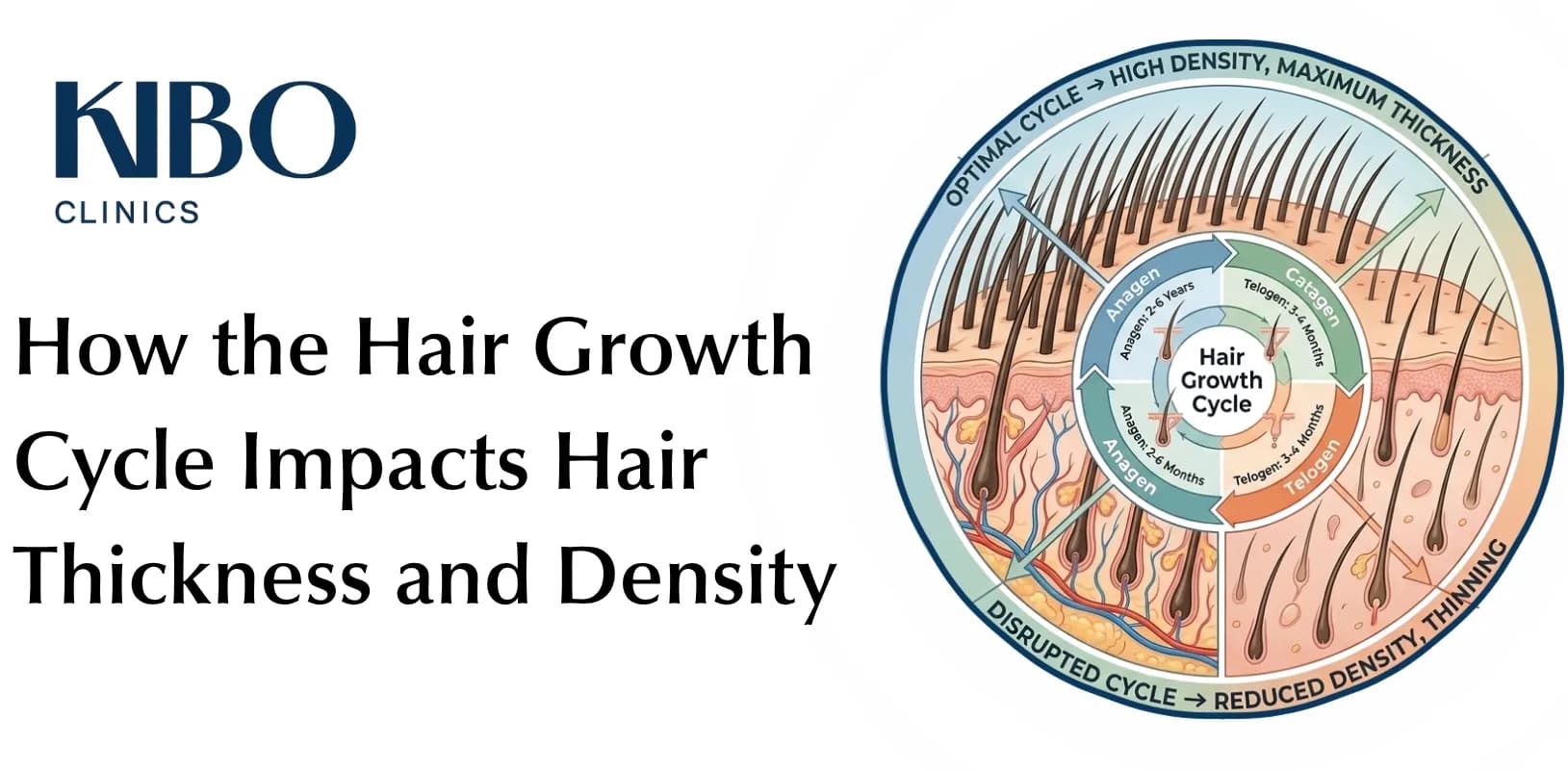 Featured image showing how the hair growth cycle affects hair thickness and density with a circular scalp-density diagram.