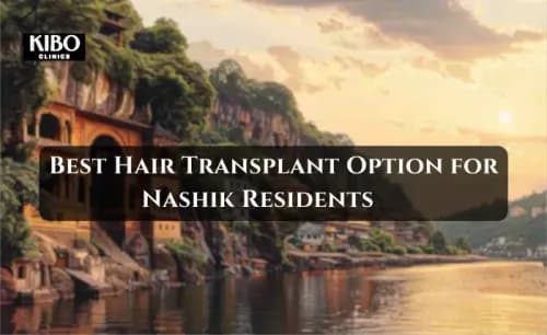 Best Hair Transplant Option for Nashik Residents: Local vs Mumbai Clinics
