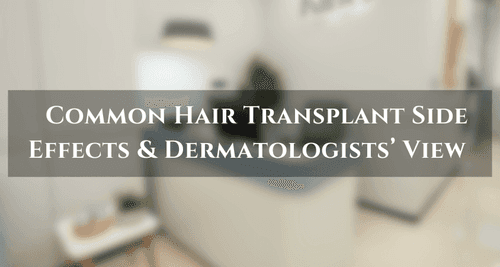 Hair Transplant Side Effects: Complete Patient Guide