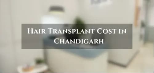 Hair Transplant Cost in Chandigarh – Best Hair Transplant Clinic in Chandigarh