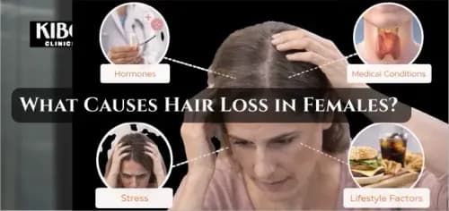What Causes Hair Loss in Females? Understanding the Real Triggers